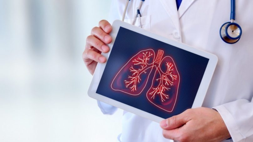 Investigan cómo afecta la COVID a pacientes receptores de trasplantes de órganos