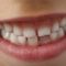 Revisiones dentales gratuitas para pacientes pediátricos